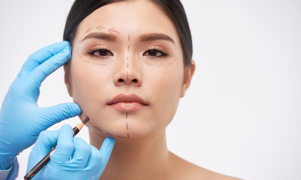 Cosmetic surgeon drawing lines on face of young beautiful woman